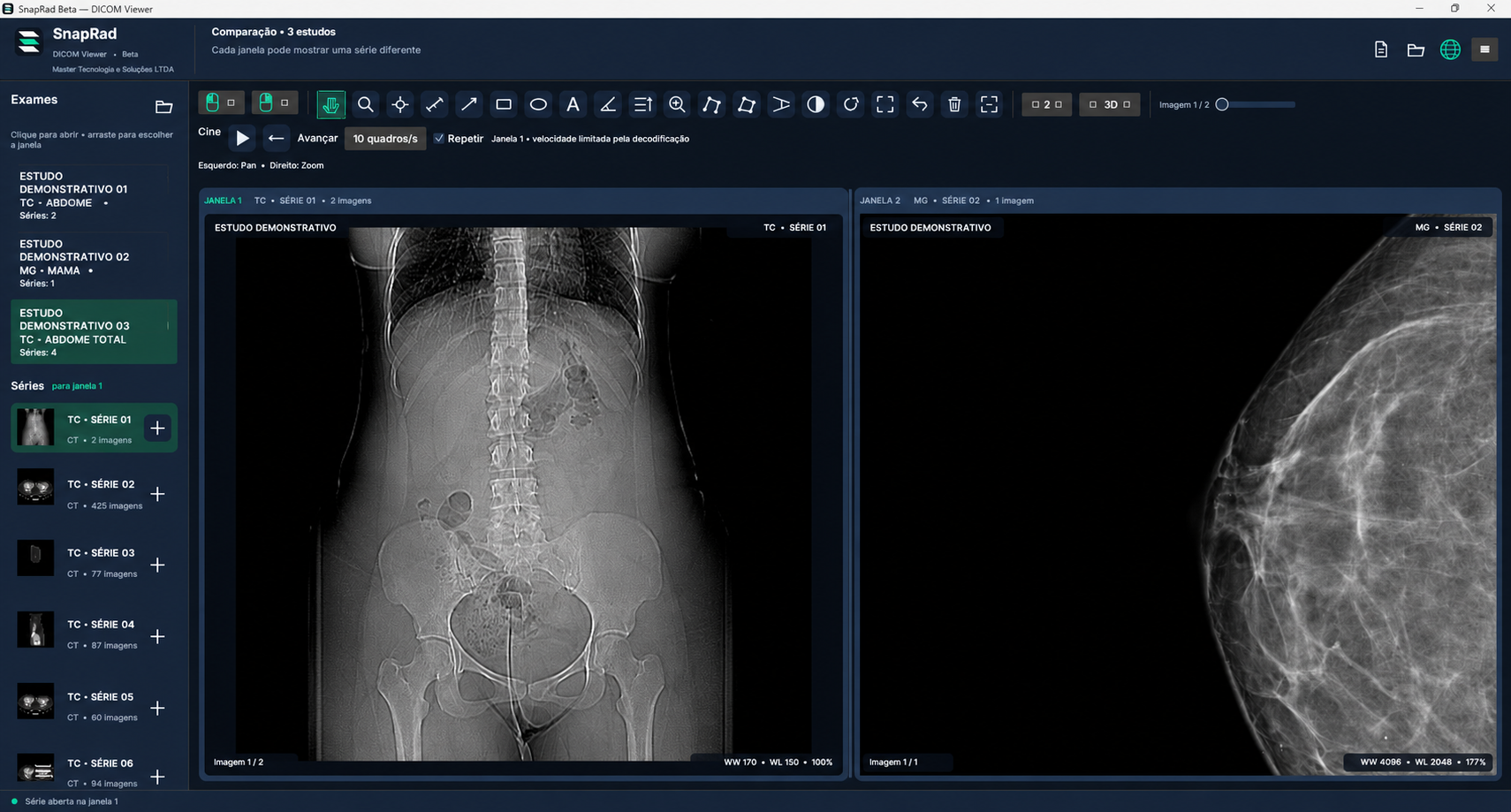 Exemplo da área de visualização: comparação de imagens DICOM, com dados demonstrativos.